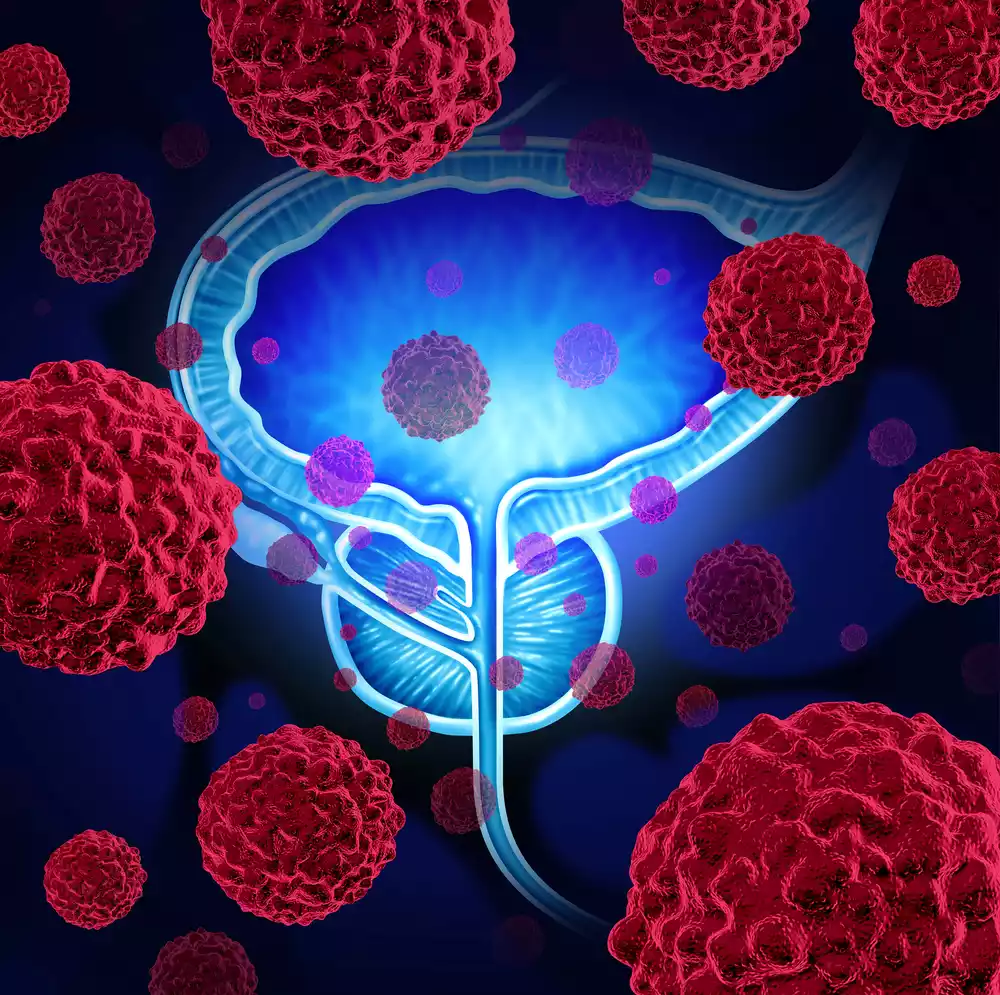 cáncer de prostata